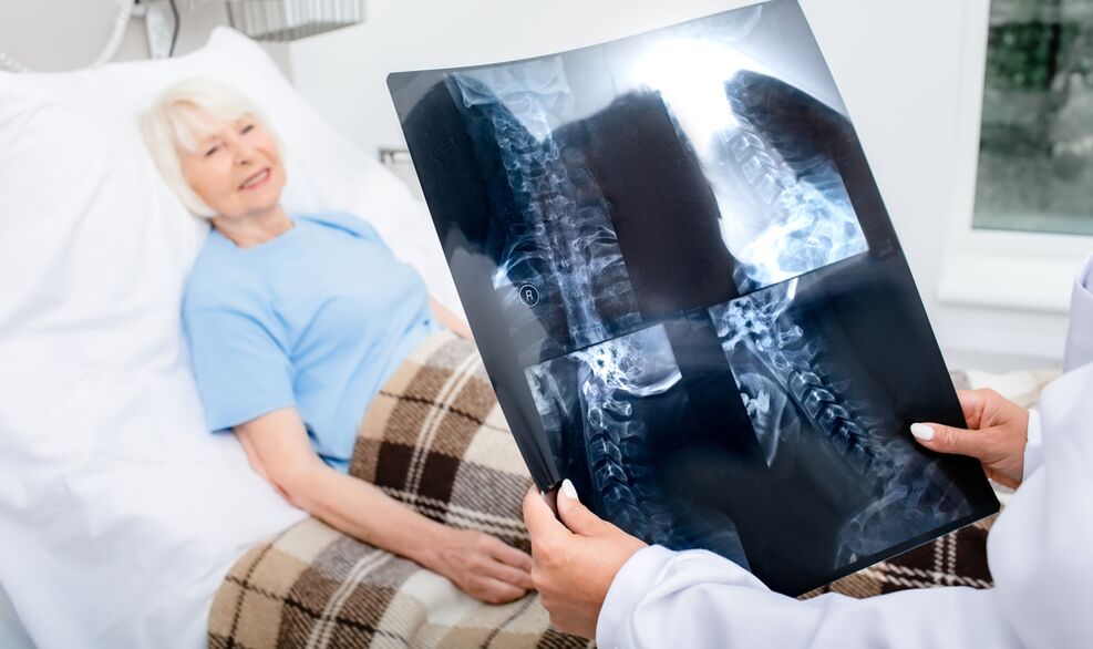 Diagnose einer Osteochondrose