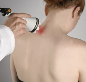 Die Lasertherapie hilft, Entzündungen zu lindern und die Geweberegeneration im Nacken zu aktivieren