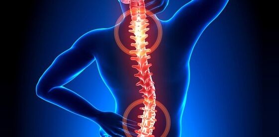 Symptome von Rückenschmerzen