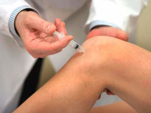 Die intraartikuläre Injektion ist eine der fortschrittlichsten Behandlungsformen bei Arthrose des Kniegelenks