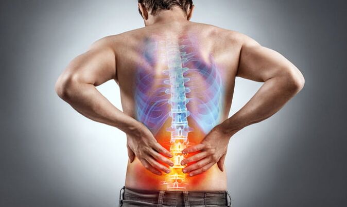 Ursachen für Schmerzen im unteren Rücken