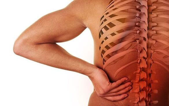 Schmerz ist das wichtigste neurologische Symptom der spinalen Osteochondrose
