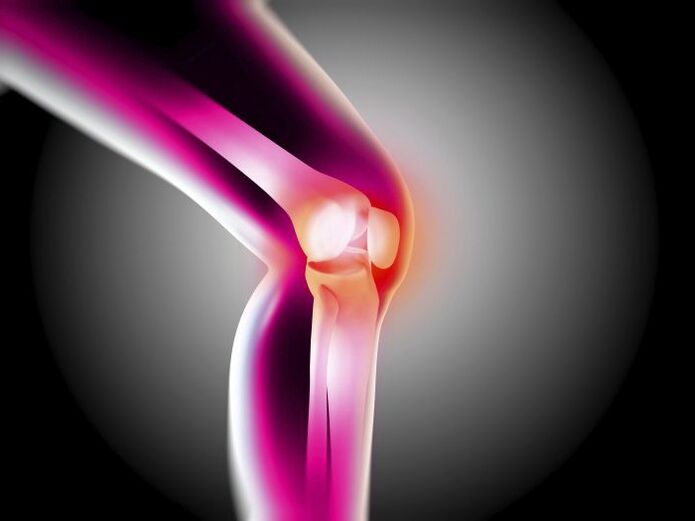 Arthrose